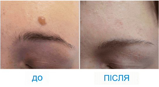 Картинка продукта