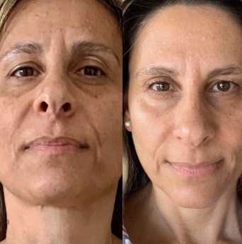 Картинка продукта