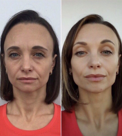 Картинка продукта