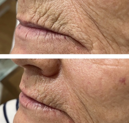 Картинка продукта