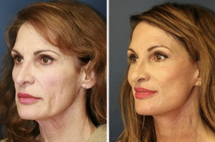 Картинка продукта