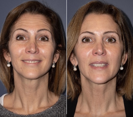 Картинка продукта