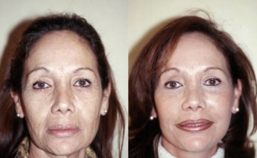 Картинка продукта