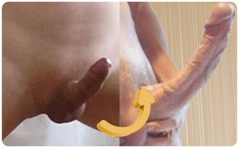 testimonial before and after