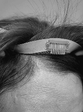 befor treatment