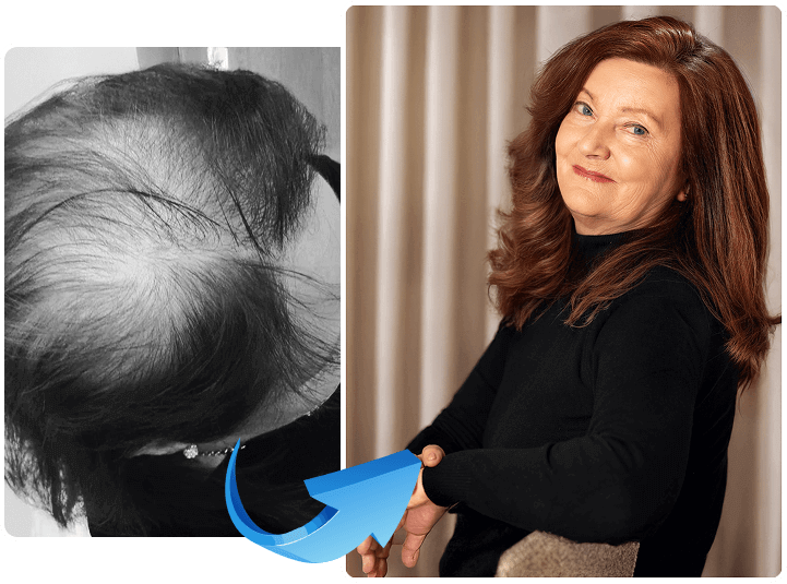 a photo before and after treatment