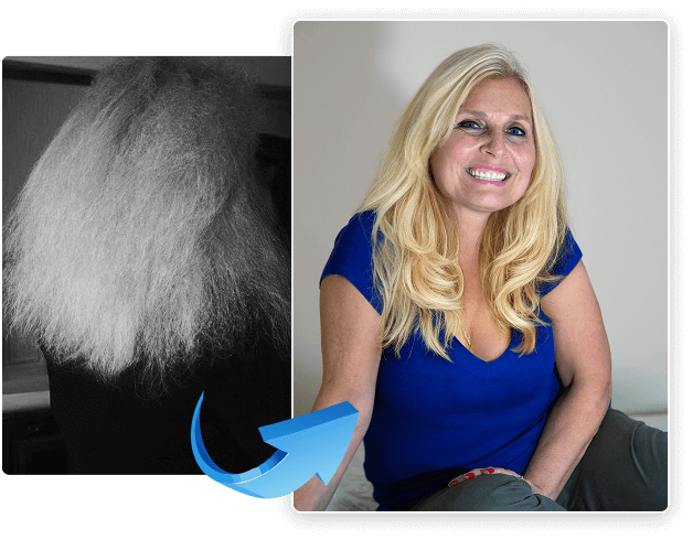 a photo before and after treatment