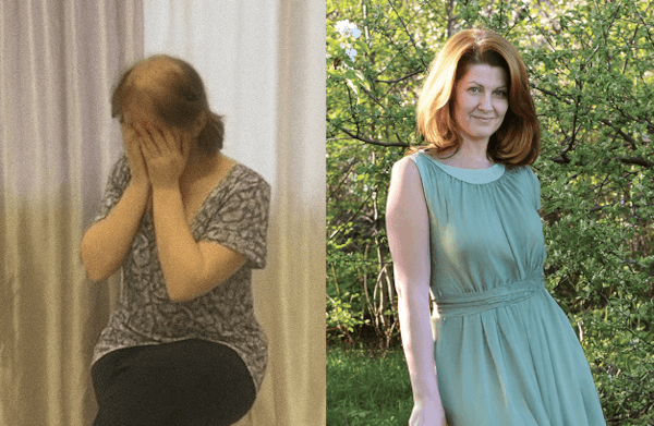 photo before and after treatment