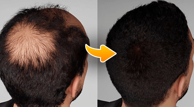 photo before and after treatment