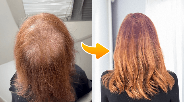 photo before and after treatment