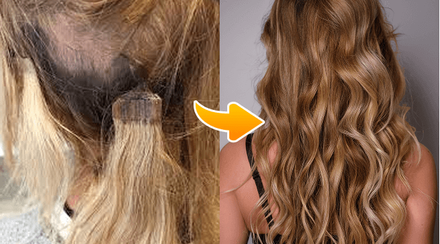 photo before and after treatment