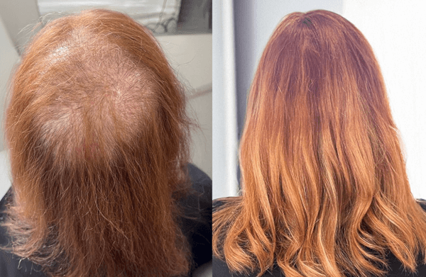 photo before and after treatment