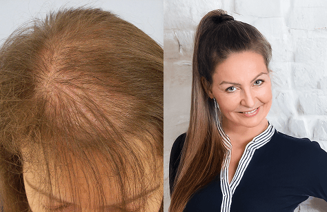 before and after usage