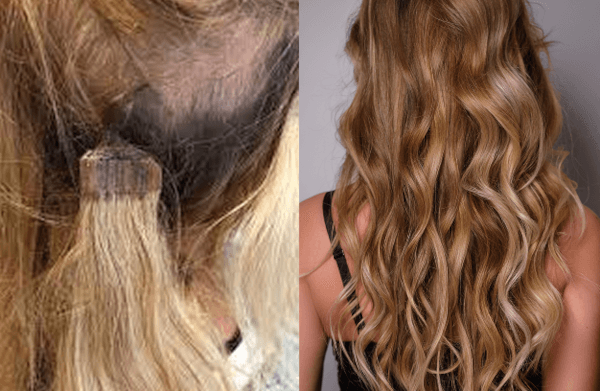 photo before and after treatment