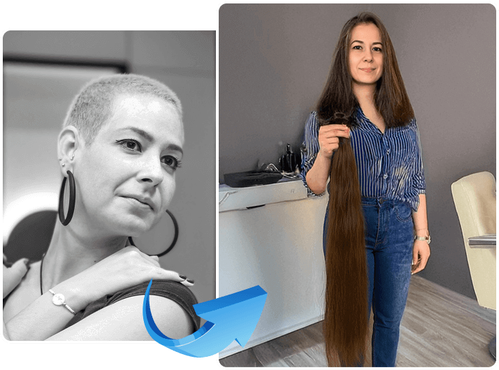 a photo before and after treatment