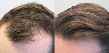 photo before and after