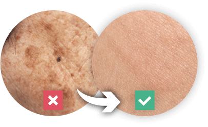 before and after use