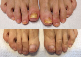 Before/after product usage