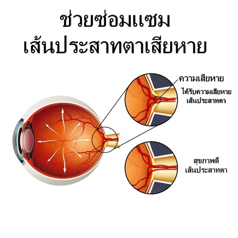 ATTDX Treatment EyeProblems SolutionDrops