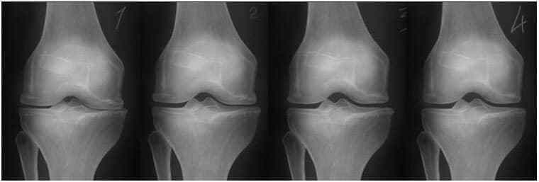 Суглоби знімок