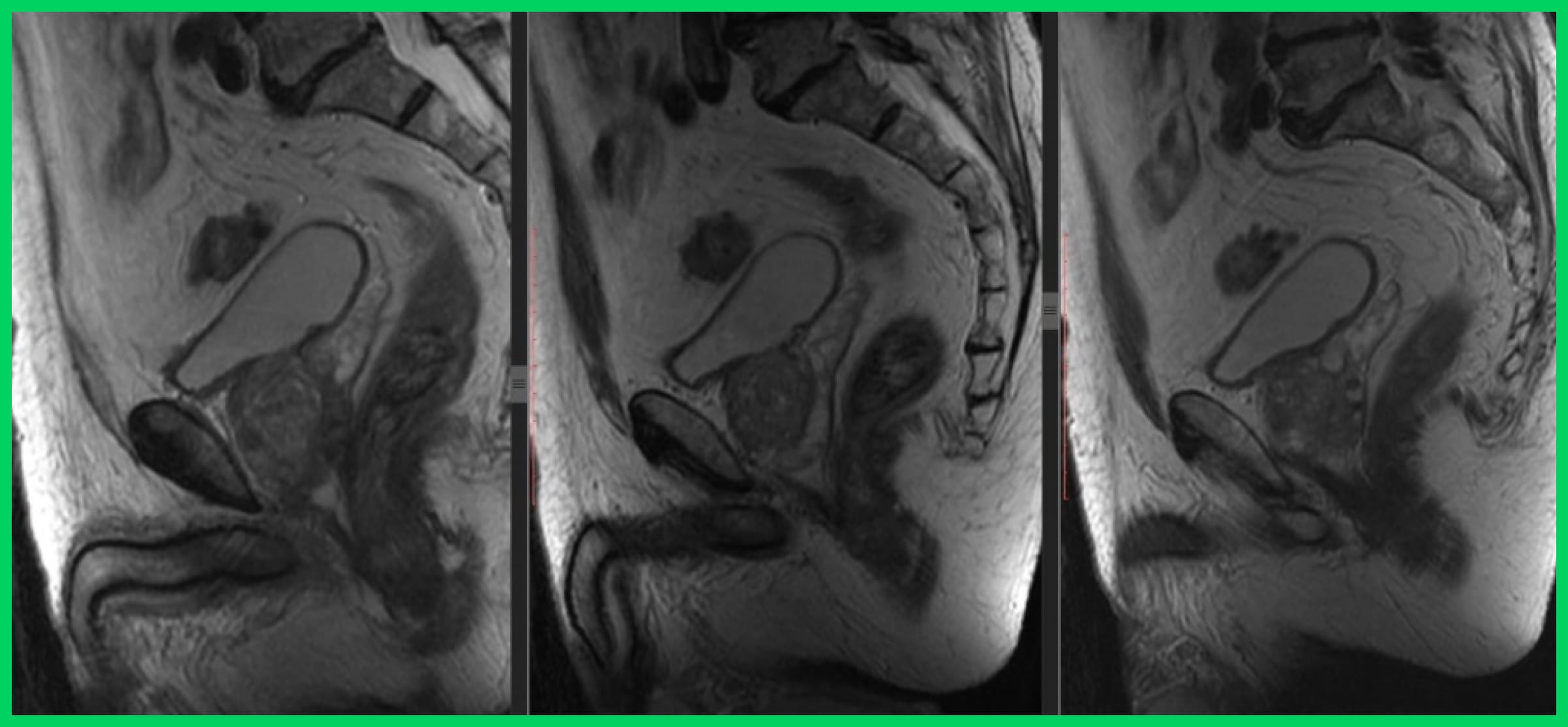 الأشعة السينية