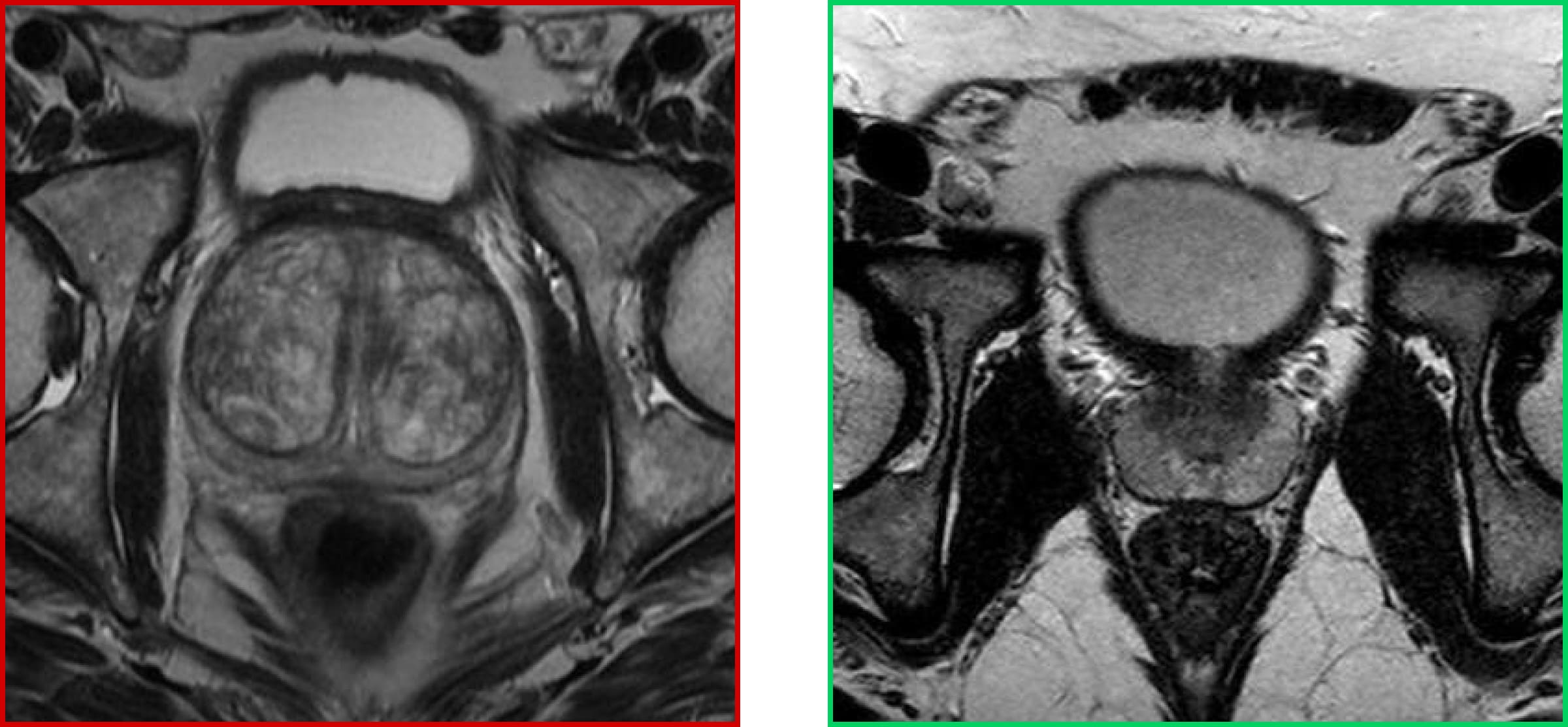 الأشعة السينية