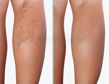 Картинка продукта