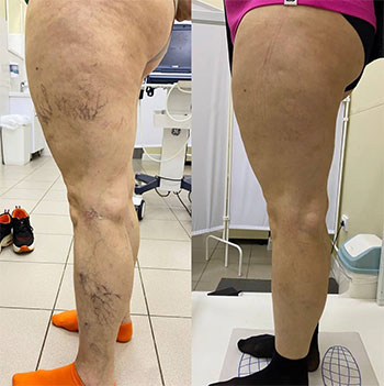 Картинка продукта