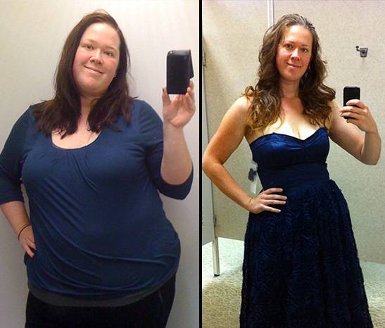 Zdjęcie po kuracji oschudzającej