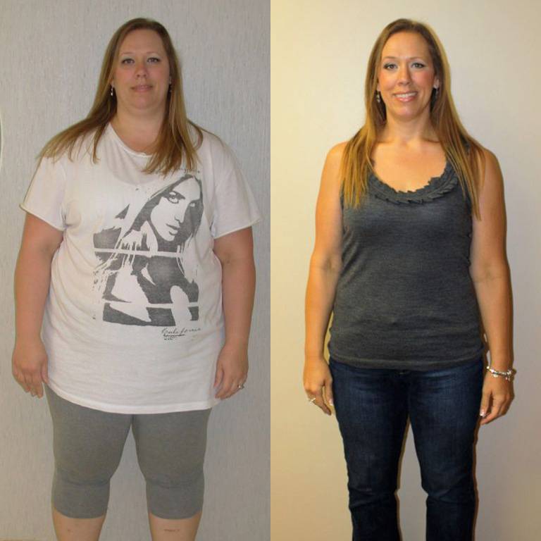 Zdjęcie po kuracji oschudzającej