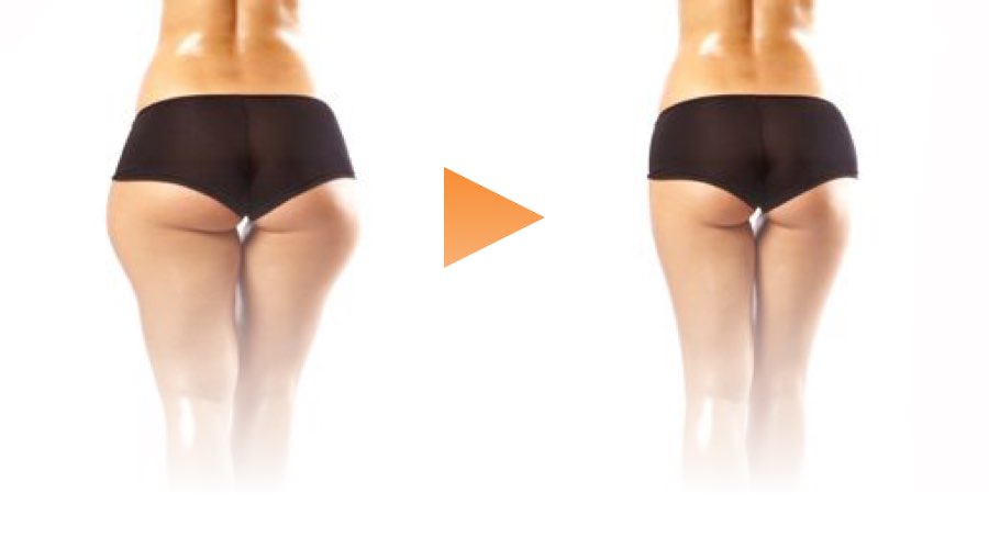 Efekt: Zmniejszenie obwodu w biodrach